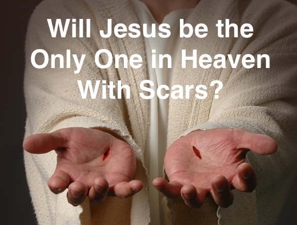 Will Jesus Be The Only One In Heaven With Scars John Michael Helms
